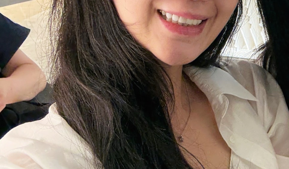 신사동 치아 삭제 없는 라미네이트, "정말 안 깎아도 되나요?" 관련 이미지 8