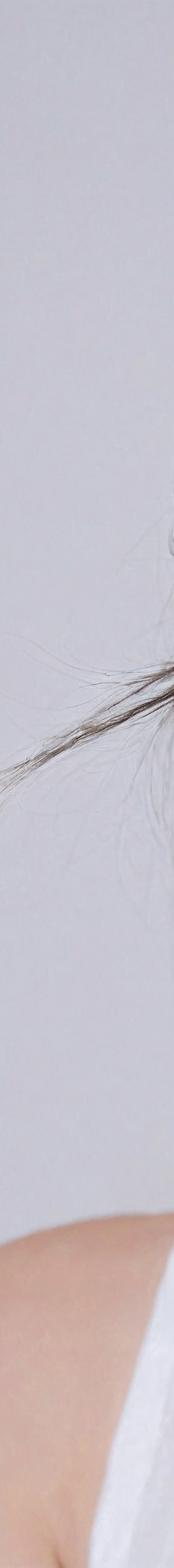 강남구무삭제라미네이트 밝은 미소 되찾기 관련 이미지 16