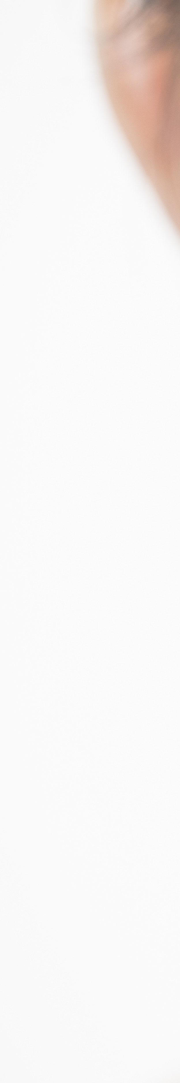 라미네이트 재시술 완벽한 미소를 위한 두 번째 여정 관련 이미지 23