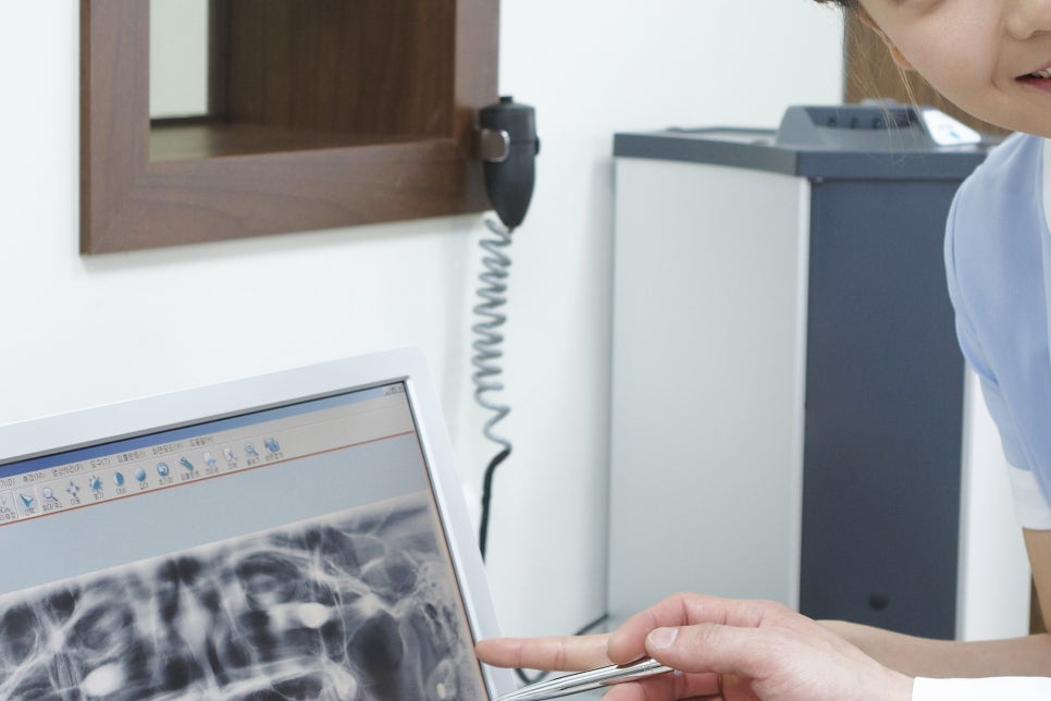 청담 무치악임플란트 틀니의 불편함을 잊도록! 관련 이미지 22