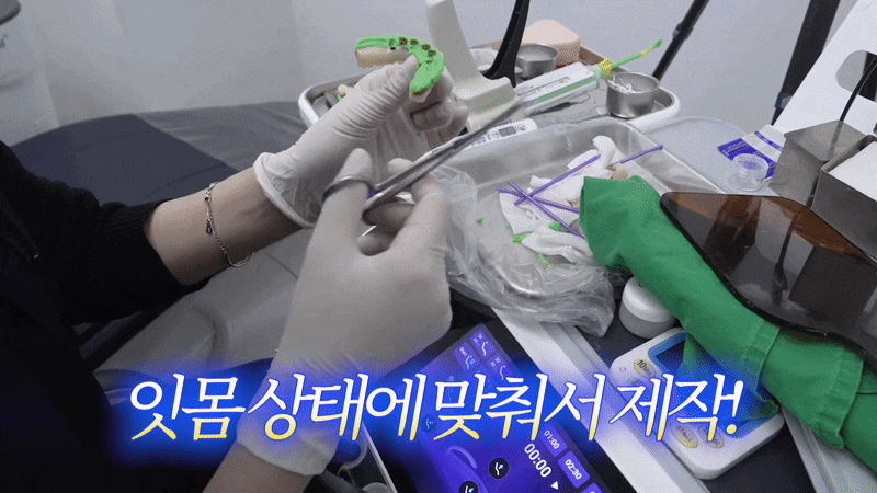 노본아치 임플란트 회복기간 뼈이식 없으면 더 빠른지 비교하기 관련 이미지 5