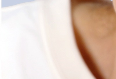 압구정로데오 임플란트 탄탄한 치아 유지는? 관련 이미지 12