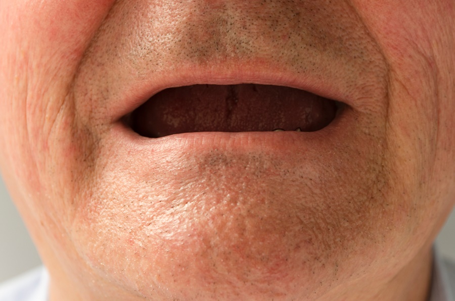 임플란트틀니잘하는곳 행복한 일상을 위한 선택 관련 이미지 9