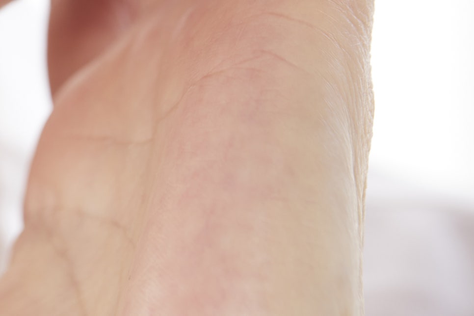 학동사거리치과 무치악 어르신들이라면? 관련 이미지 17