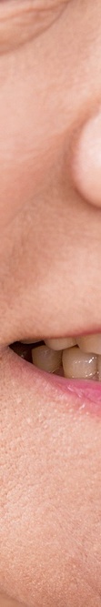 Wondering How Long Full-Arch Implant Surgery Takes? image 38