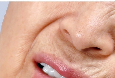 압구정로데오 임플란트 탄탄한 치아 유지는? 관련 이미지 10