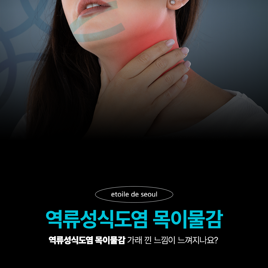 역류성식도염 목이물감 가래 낀 느낌이 느껴지나요? 관련 이미지 1