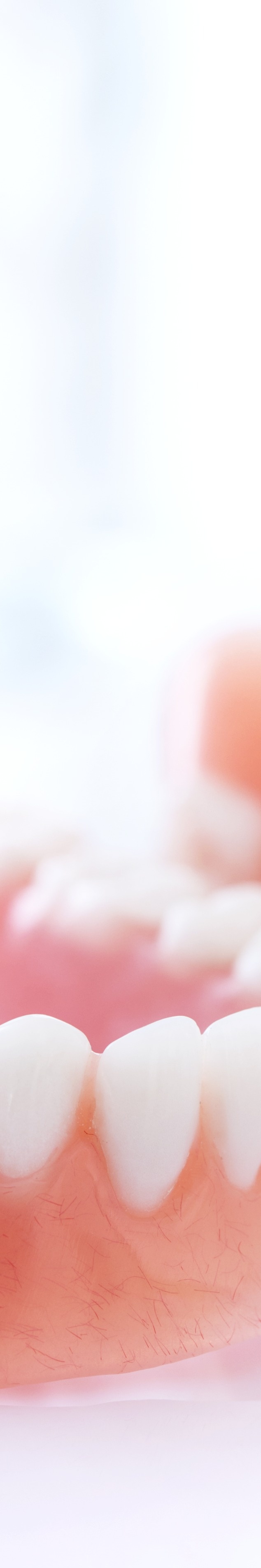 라미네이트 빠짐 이런 경우에 어떻게 해야 할까 관련 이미지 32