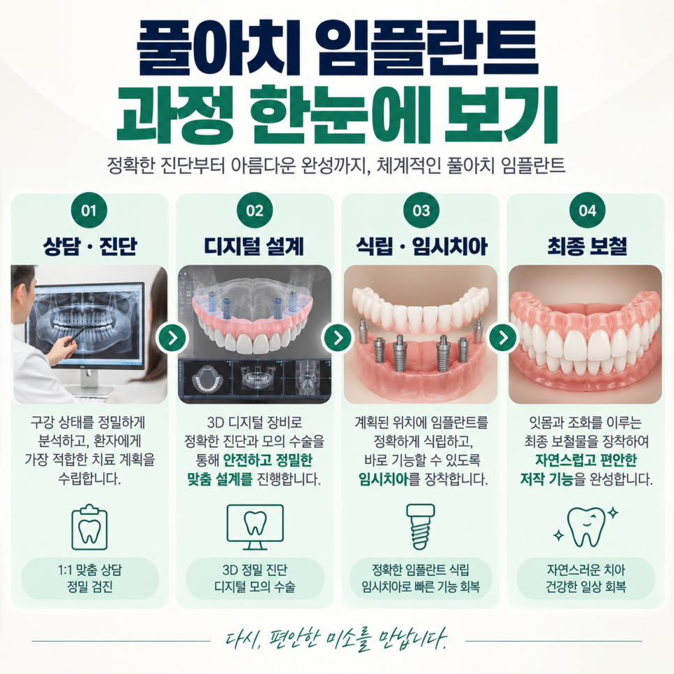 풀아치 임플란트, 어떤 순서로 진행될까요? 자주 묻는 질문 관련 이미지 6