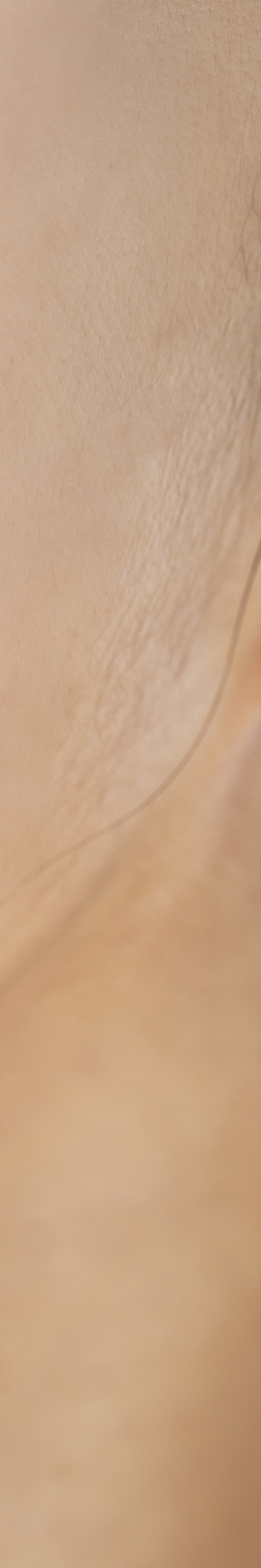 앞니임플란트잘하는곳 당신의 웃음을 찾아드립니다 관련 이미지 29