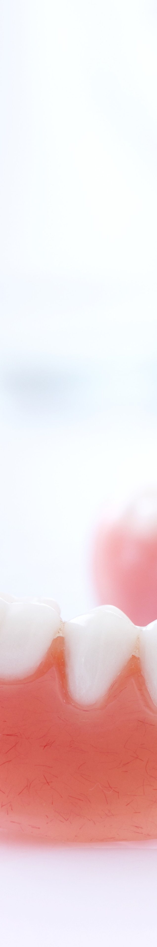 라미네이트 빠짐 이런 경우에 어떻게 해야 할까 관련 이미지 31