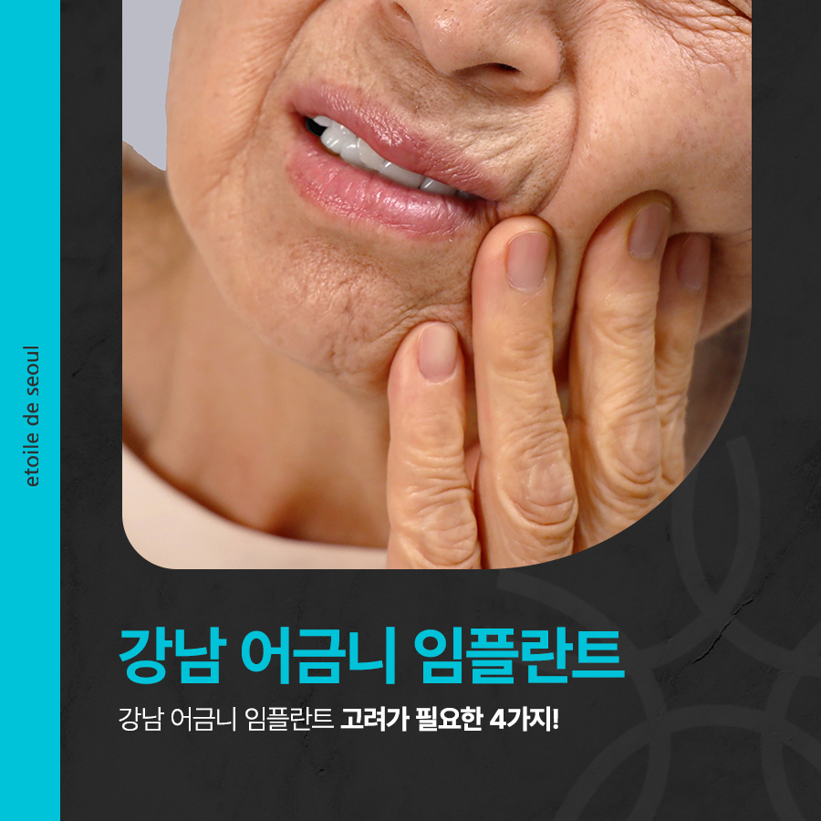 강남 어금니 임플란트 고려가 필요한 4가지! 관련 이미지 1