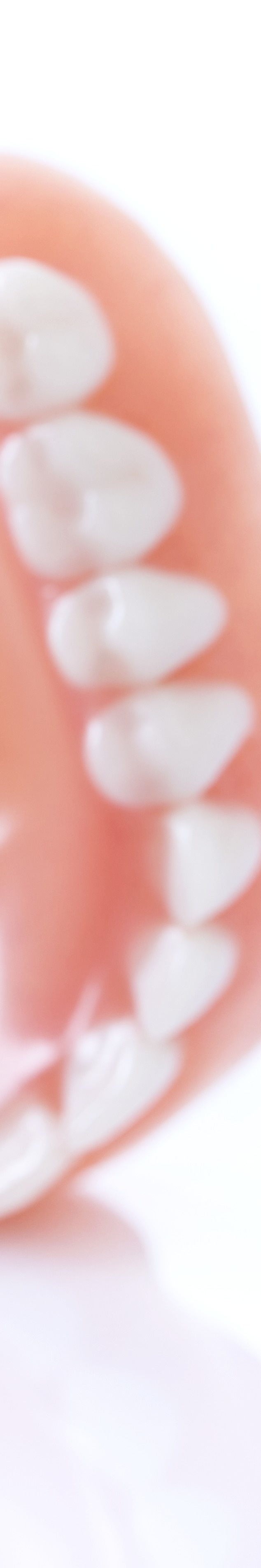 라미네이트 빠짐 이런 경우에 어떻게 해야 할까 관련 이미지 35