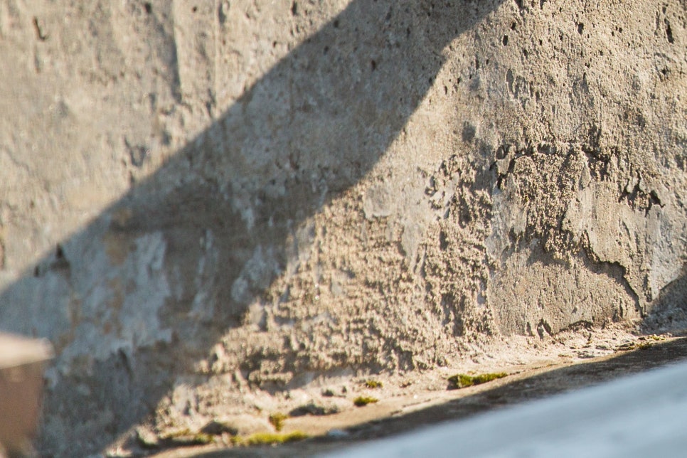 여자 사타구니 통증 고관절이 문제일까? 관련 이미지 13