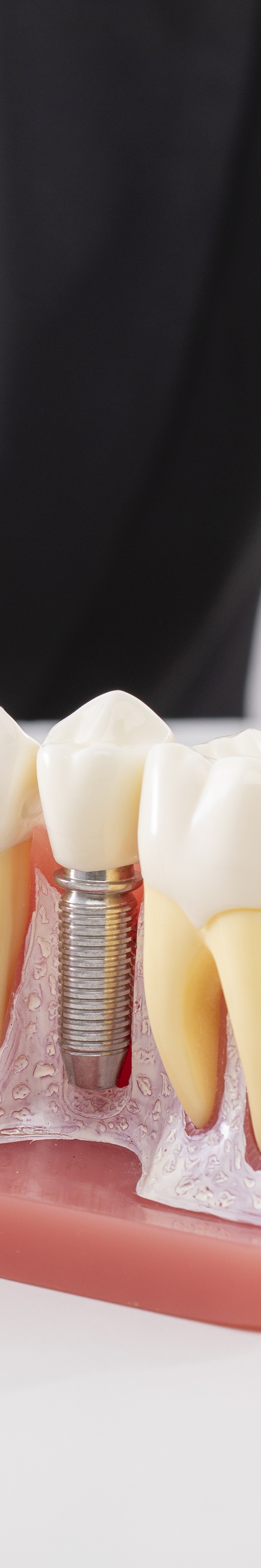 청담임플란트 한 번의 선택으로 즐기는 편안함 관련 이미지 28