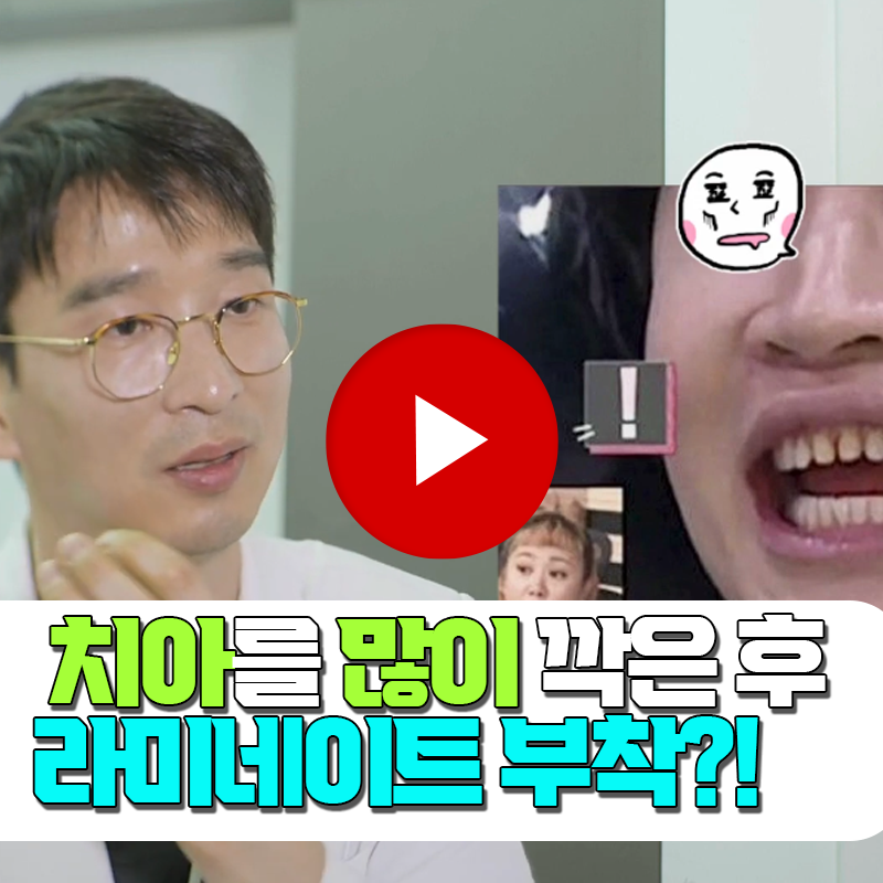 압구정 앞니 라미네이트, 색만 보고 결정하면 나중에 아쉬워지는 이유 관련 이미지 2