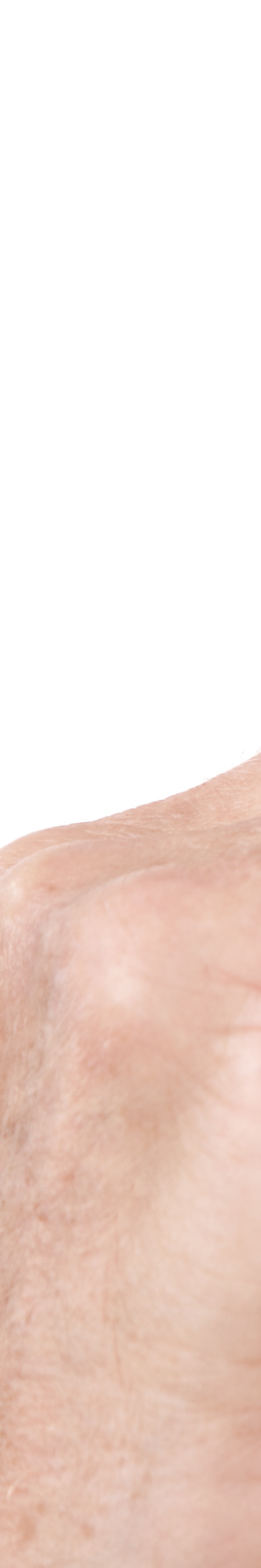 임플란트임시틀니 착용 기간과 교체 시기 관련 이미지 24