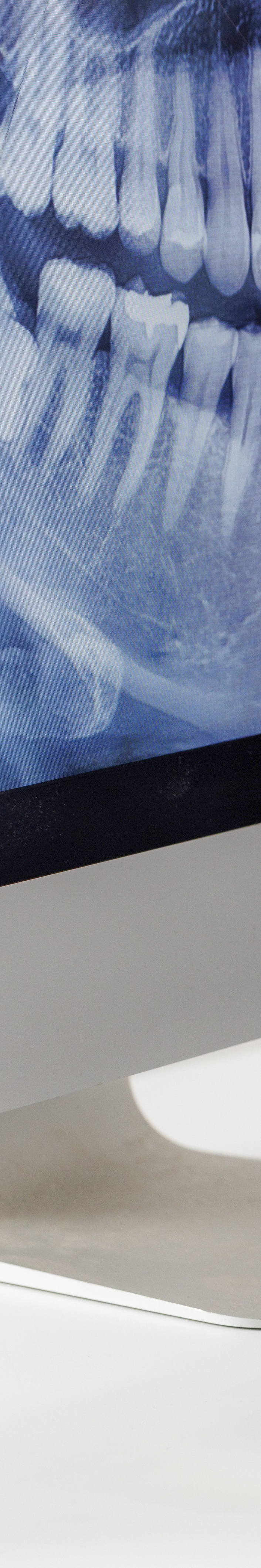 압구정 전체임플란트비용 선택 기준 7가지 살펴보기 관련 이미지 17