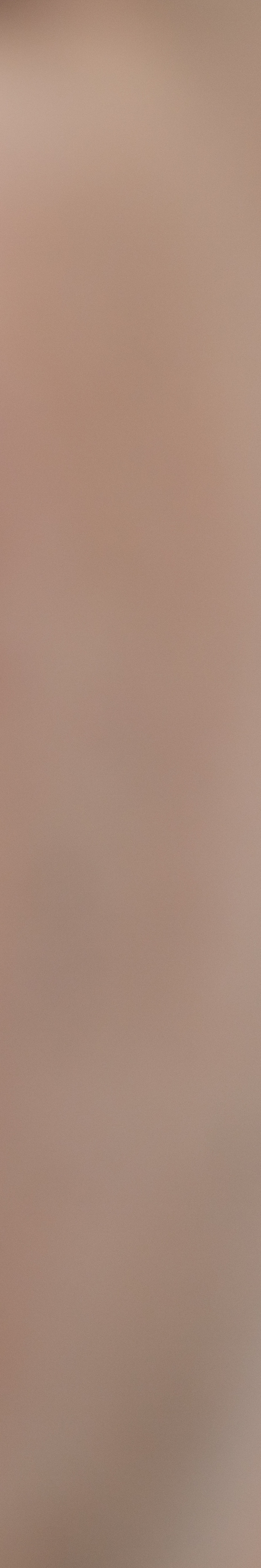 올온엑스 임플란트 과연 해결이 가능할까 관련 이미지 37