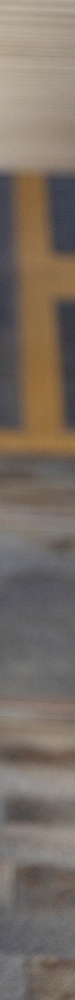 Worried That Apgujeong Veneers Might Be Too White? image 36
