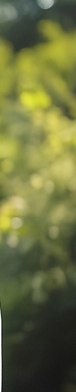 풀아치 임플란트 통증 걱정 때문에 망설이셨다면 치료 전에 알아야 할 5가지 관련 이미지 29