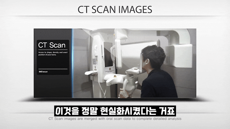 임플란트보증기간 꼼꼼히 확인해야 할 점 관련 이미지 6