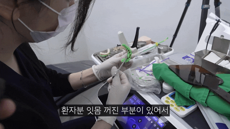 노본아치 임플란트 회복기간 뼈이식 없으면 더 빠른지 비교하기 관련 이미지 4