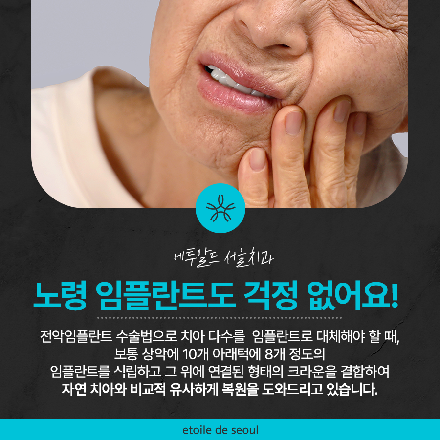 압구정로데오 임플란트 탄탄한 치아 유지는? 관련 이미지 2