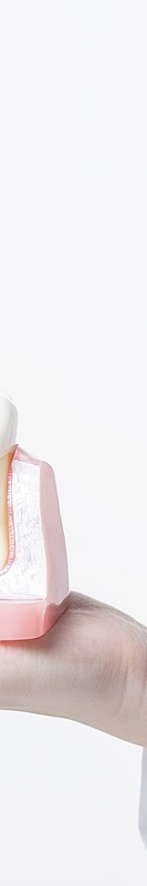 서울임플란트잘하는곳 찾아보고 선택하세요 관련 이미지 39