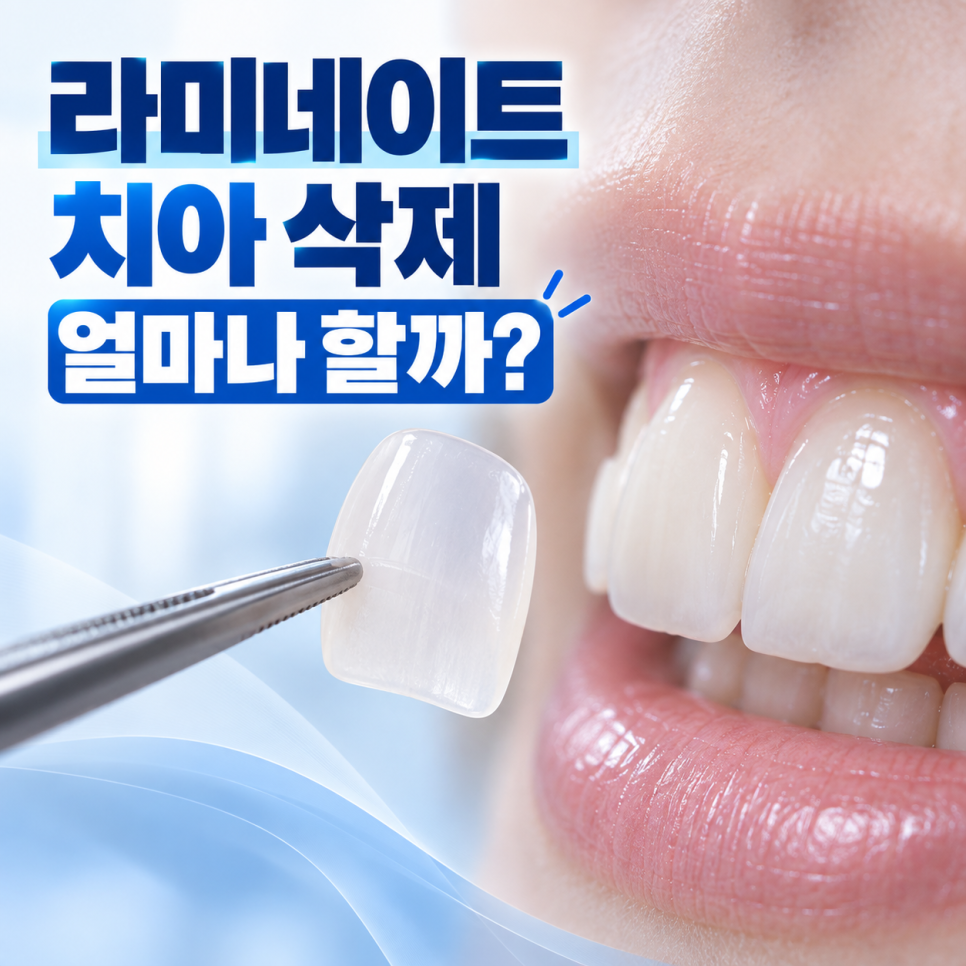 라미네이트 치아 삭제 얼마나 하나요? 삭제량 줄이는 방식과 가능한 경우 관련 이미지 3