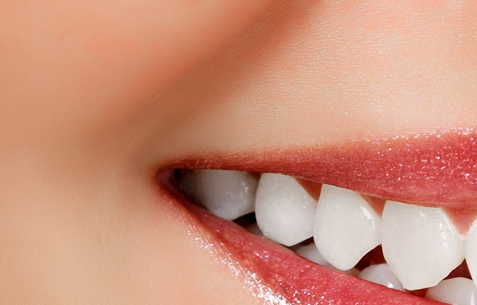 풀아치 임플란트 무치악으로 고생한다면? 관련 이미지 18