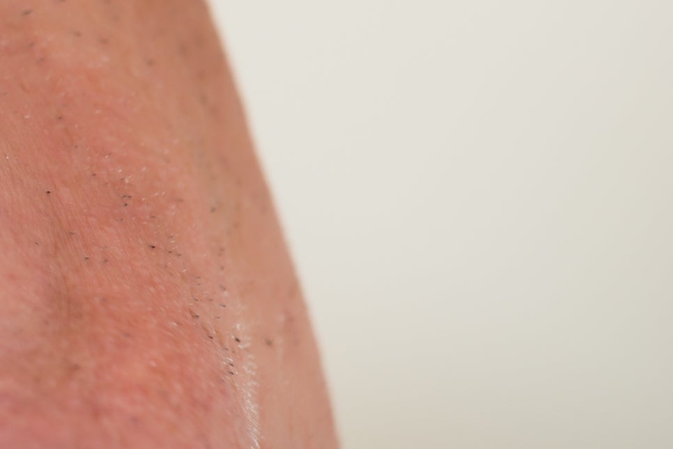 강남 노인임플란트 삶의 질이 달라져요 관련 이미지 17