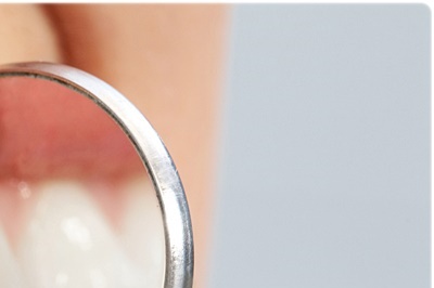 청담동치과 추천 앞니가 부러졌어요! 관련 이미지 21