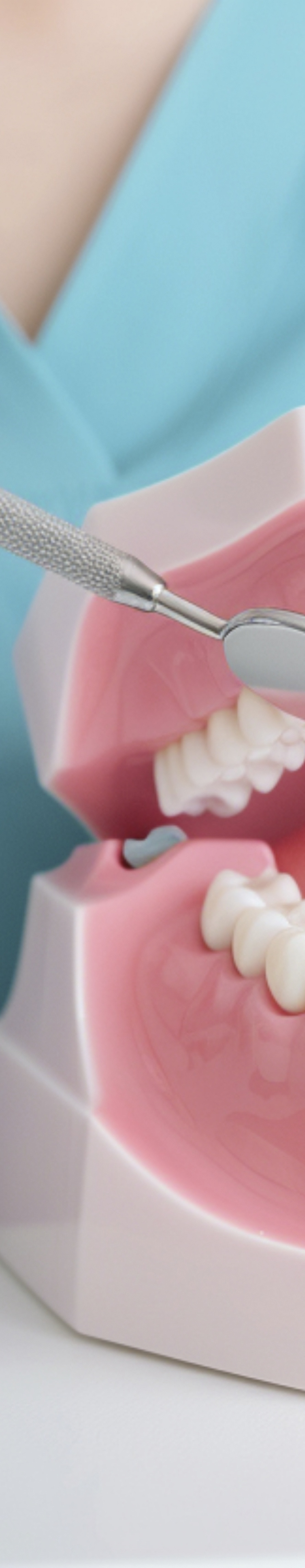 라미네이트 빠짐 이런 경우에 어떻게 해야 할까 관련 이미지 24