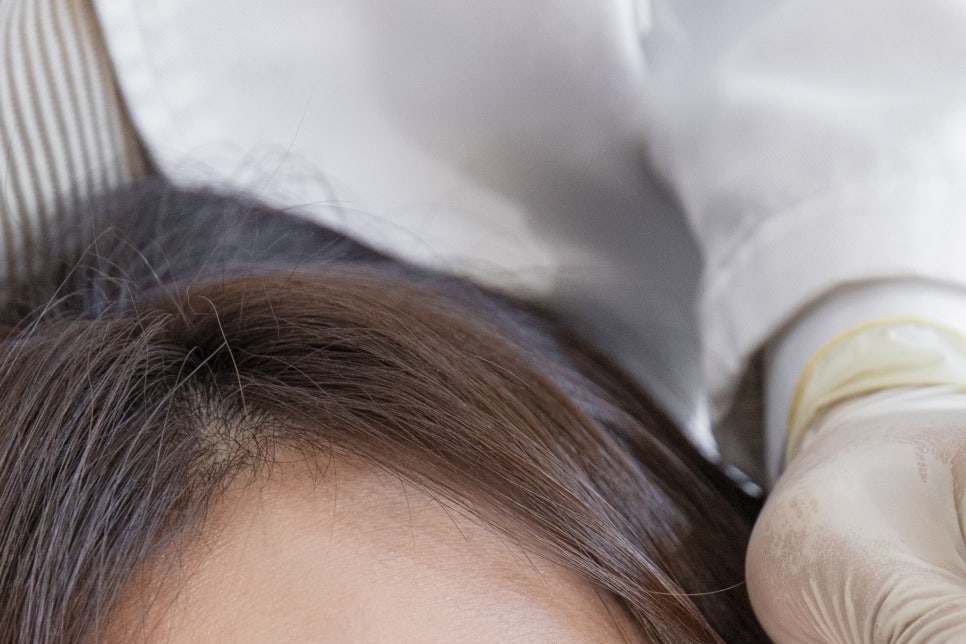 청담동 임플란트 재수술로 이어지지 않게! 관련 이미지 10