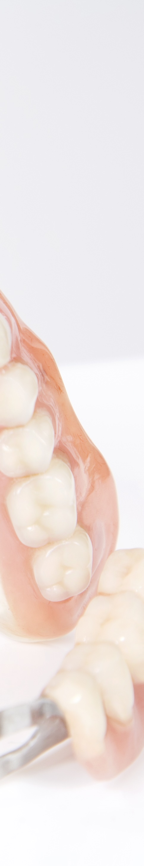 임플란트임시틀니 착용 기간과 교체 시기 관련 이미지 21