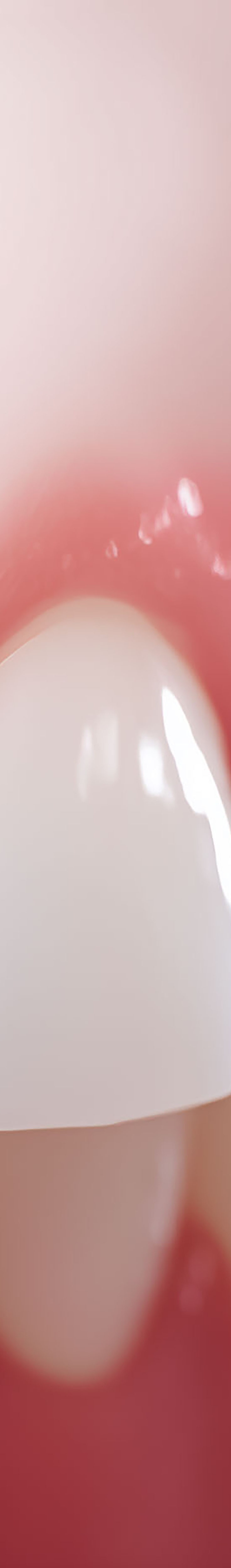 압구정로데오치과 라미네이트 어떤 포인트를 체크해야 할까 관련 이미지 25