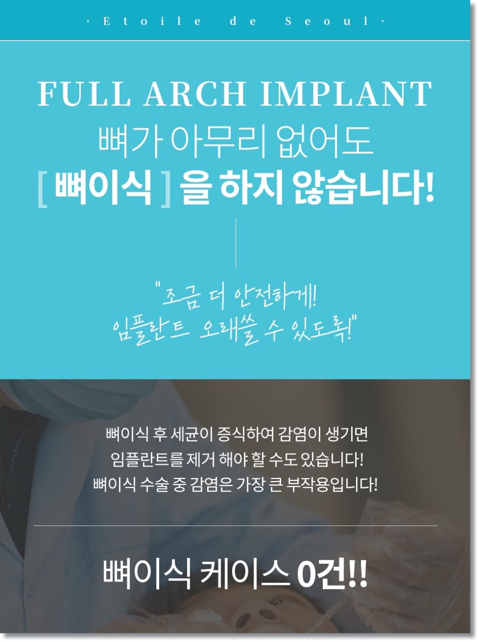 전체 임플란트, 임시치아 당일 장착이 가능한 조건과 치료 과정 관련 이미지 7
