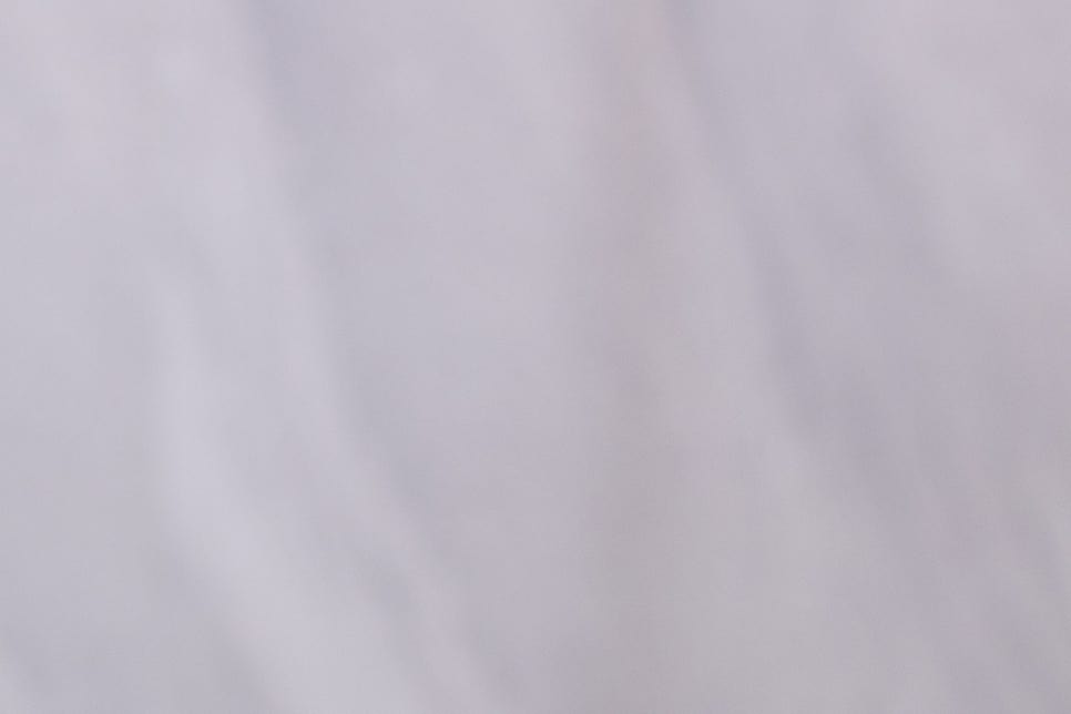 강남 풀아치임플란트 아리따운 미소를 되찾아 관련 이미지 17