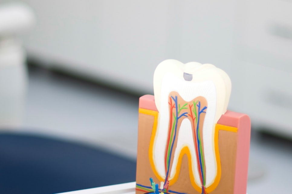 청담 어금니임플란트 저작하는 힘을 생각해 관련 이미지 22