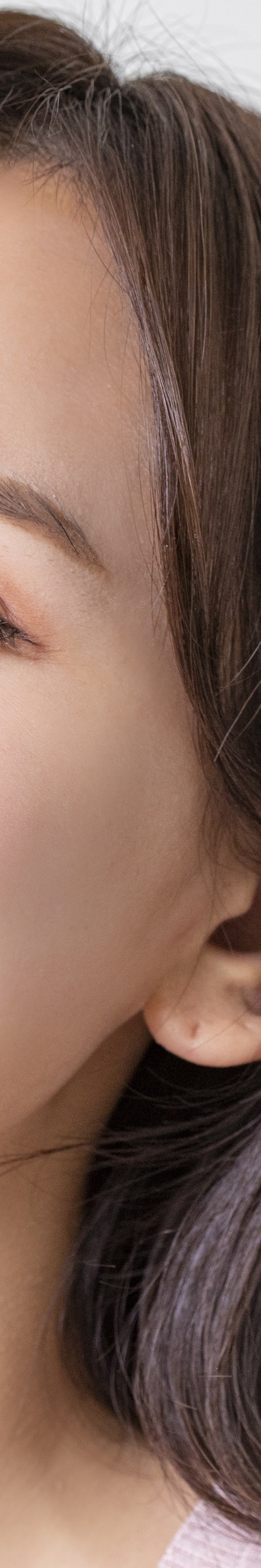 아랫니 라미네이트 숨겨왔던 미소를 되찾는 여정 관련 이미지 29