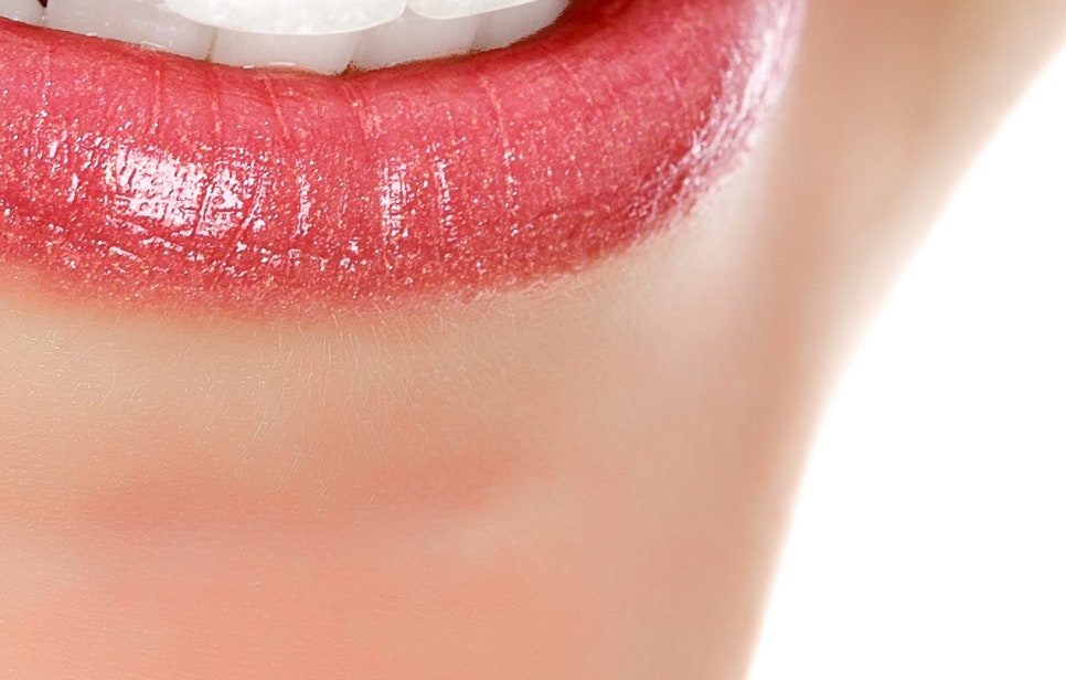 풀아치 임플란트 무치악으로 고생한다면? 관련 이미지 22