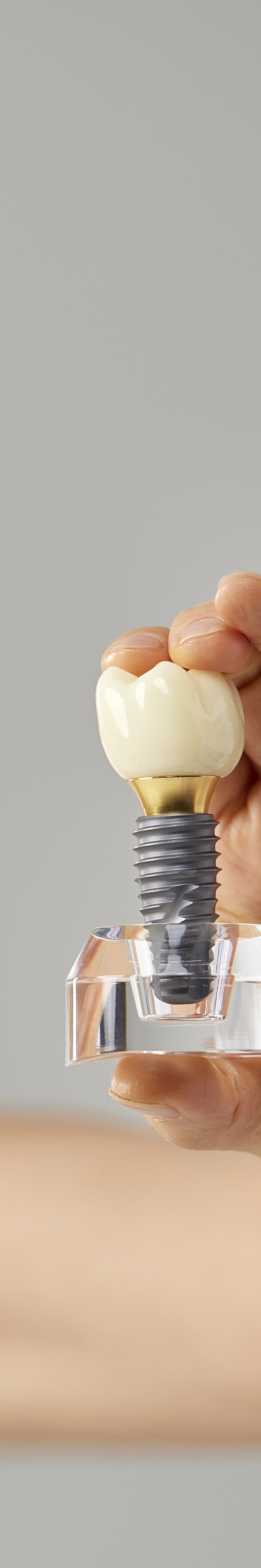 임플란트 임시틀니 빠졌을 때 당황하지 말고 이것부터 관련 이미지 25