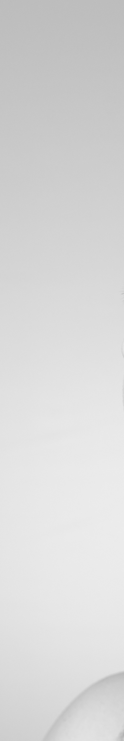 전체임플란트잘하는곳 치아 고민 끝에 만난 새로운 시작 관련 이미지 25