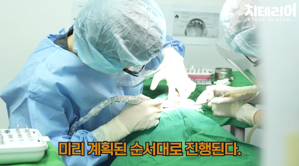 치테리어가 추천하는 풀아치 임플란트 관련 이미지 11