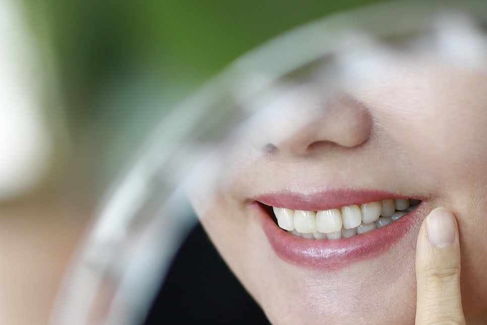 풀아치임플란트 비용 주의사항도 익혀보기 관련 이미지 18