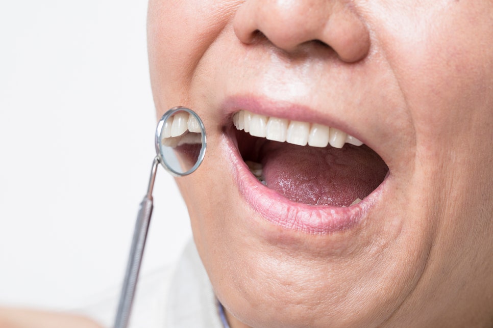 네비게이션임플란트가격 부담을 덜 수 있는 방법 관련 이미지 5