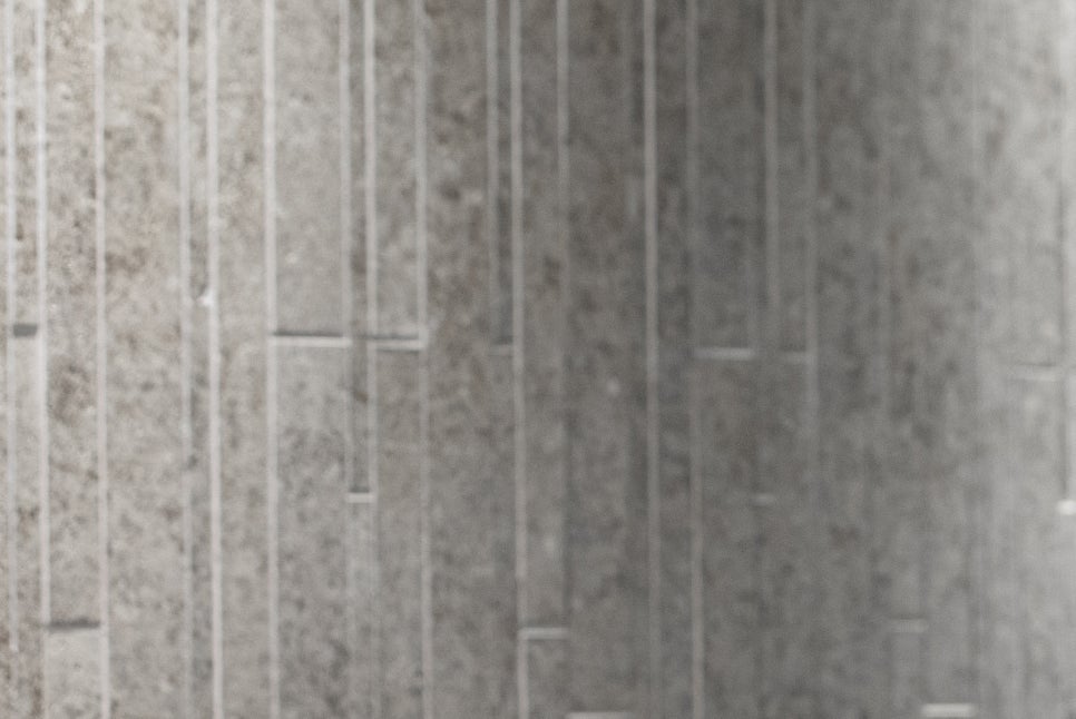 강남구 임플란트 세 가지 체크하고 결정하자! 관련 이미지 21