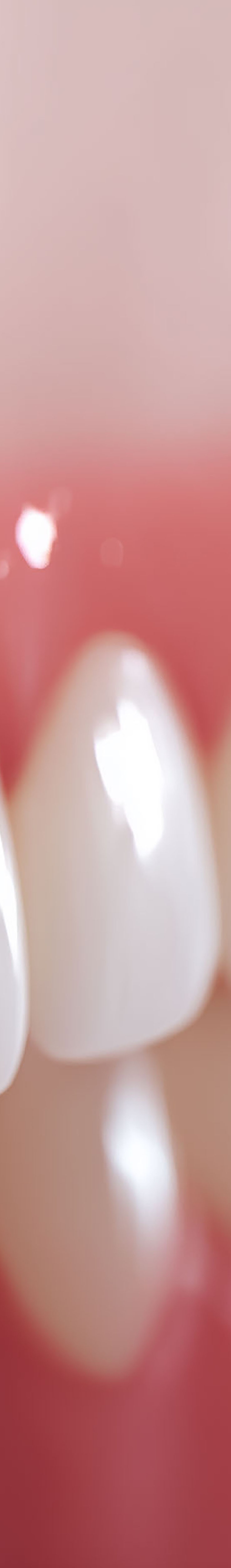 압구정로데오치과 라미네이트 어떤 포인트를 체크해야 할까 관련 이미지 26