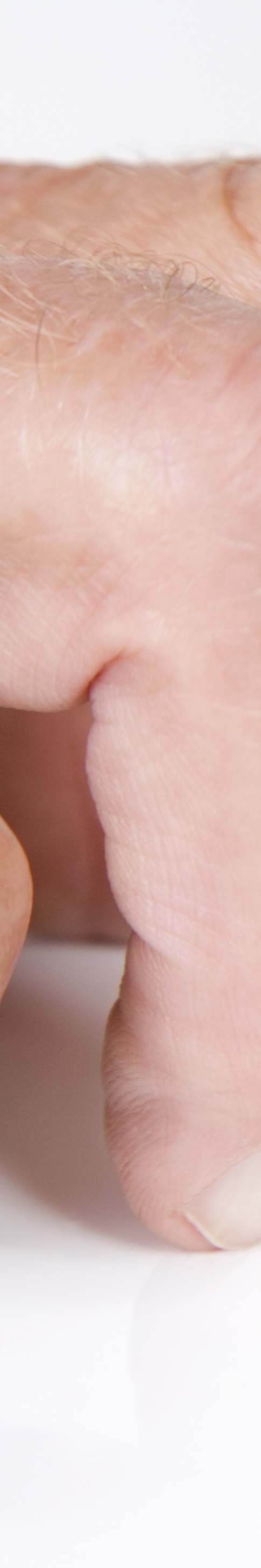 임플란트임시틀니 착용 기간과 교체 시기 관련 이미지 15